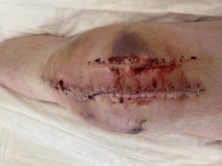 Name:  902A4149-456E-4495-A3CC-577A64AD64B1.jpeg
Views: 886
Size:  20.4 KB